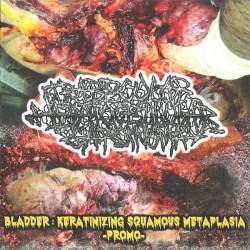 Trabecular Hepatocellular Carcinoma : Bladder : Keratinizing Squamous Metaplasia